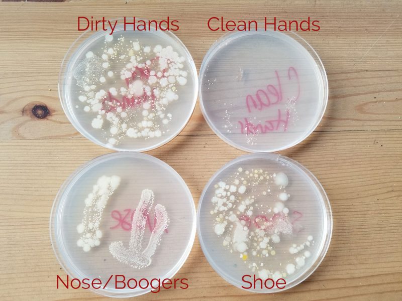Let's Talk About Germs - 4 Petri Dish Germ Growth